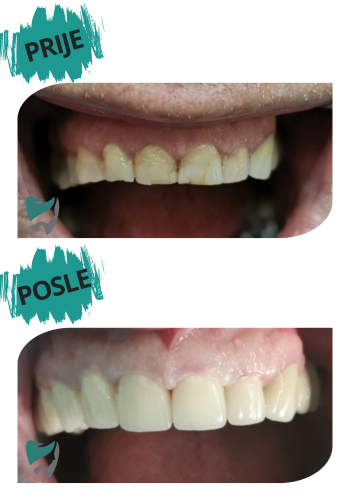 POSLE (1)