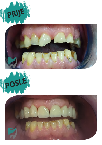 POSLE (1)